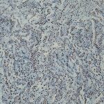 Jean-NO HELL - Atlantide - 2022